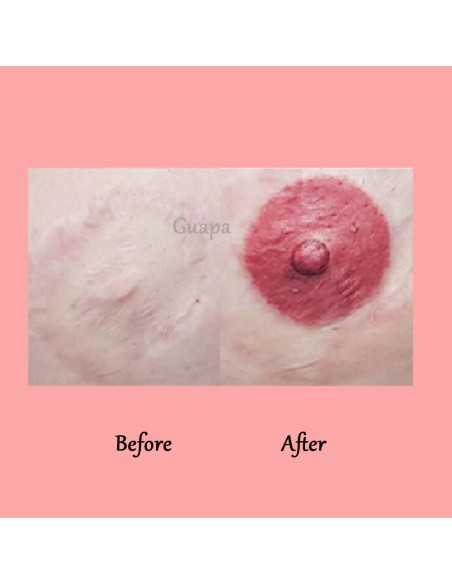 Herramienta de micropigmentación para la reconstrucción del pezón